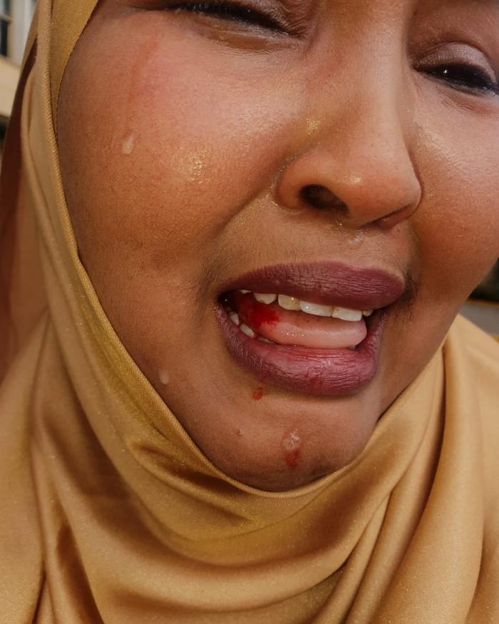 Female MP beaten up in Kenya by colleague