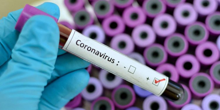 Coronavirus Getty