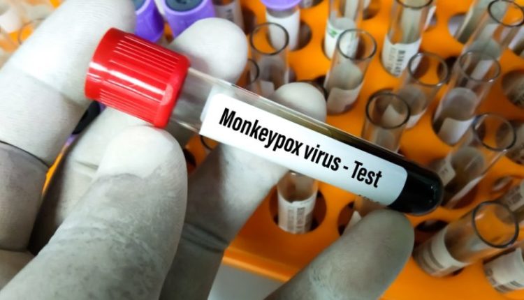 monkey-pox virus test, US, Nigeria