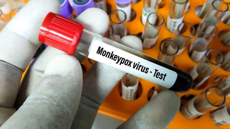 monkey-pox virus test, US, Nigeria