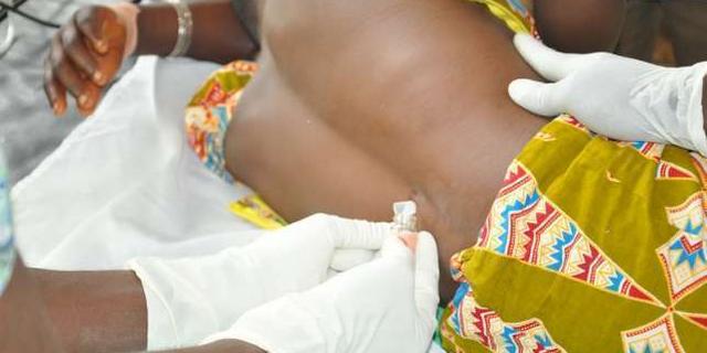 CSM,UNICEF, WHO, NCDC. Meningitis outbreak