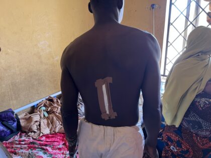 Auwalu Bala Survivors Who Was Stabbed with a Machete Photo Credit Elijah Akoji Solacebase