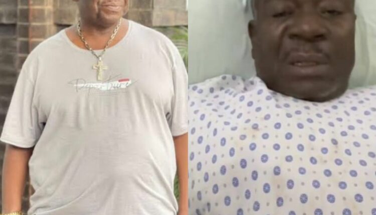 Nollywood Actor ,Mr Ibu, leg amputation, health battle
